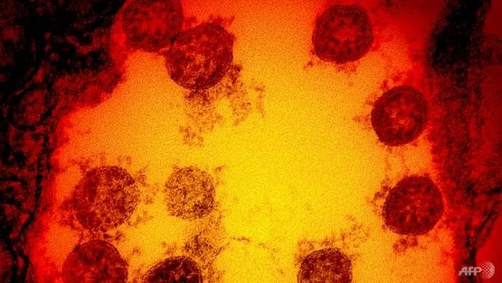 Bộ Y tế Malaysia xác nhận các ca nhiễm biến thể mới của virus SARS-CoV-2 gây bệnh Covid-19 mới được phát hiện gần đây tại Anh. (Nguồn: AFP)