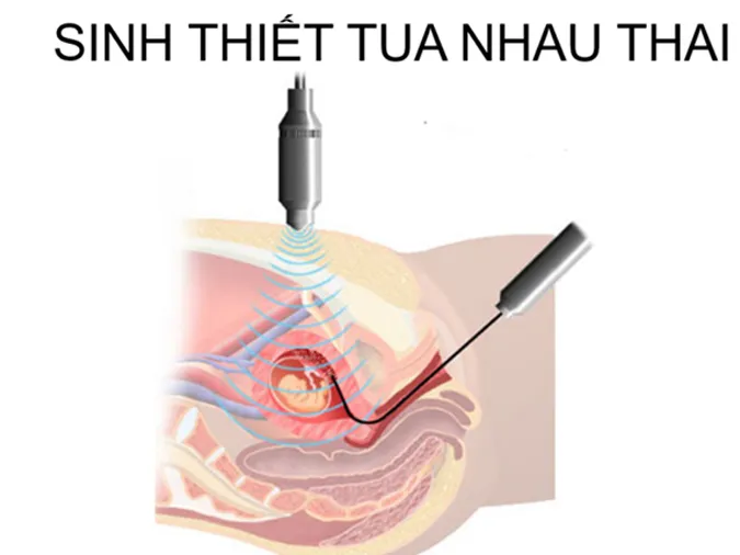 tim-hieu-nhung-phuong-phap-bao-ve-von-gen-cua-loai-nguoi-voh-2