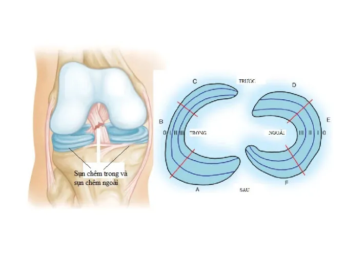 Đứt dây chằng khớp gối có nguy hiểm không? 2