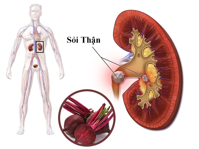 can-trong-5-tac-hai-cua-cu-den-va-3-luu-y-an-dung-cach-phai-biet-voh-0