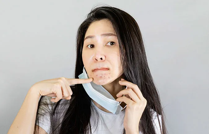 6 quy tắc chăm sóc da giúp bạn ngăn ngừa mụn khi đeo khẩu trang 1