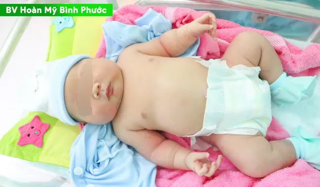 Bé trai nặng 5,2 kg chào đời tại bệnh viện Hoàn Mỹ Bình Phước 1
