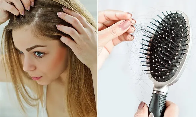 Rụng tóc nghiêm trọng mùa giãn cách, liệu bạn đã biết nguyên nhân và cách khắc phục? 1