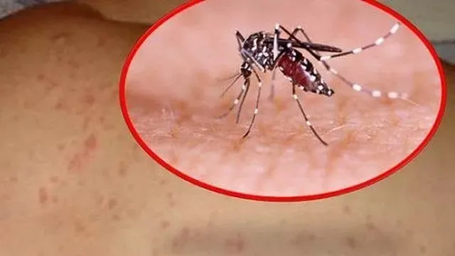 7 quan niệm sai lầm về sốt xuất huyết khiến bệnh dễ trở nặng 2