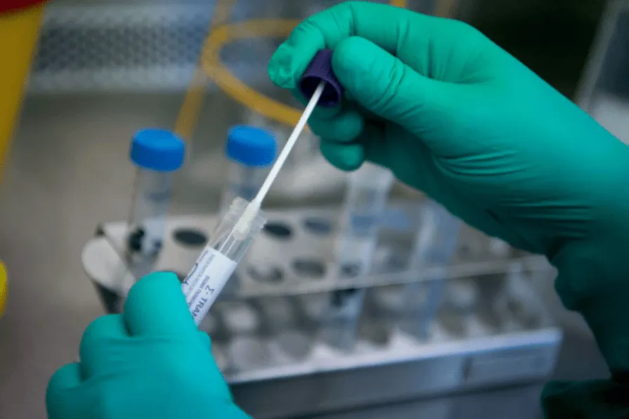 Xét nghiệm Covid-19