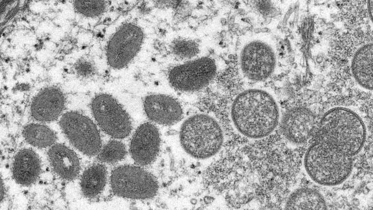 virus đậu mùa khỉ dưới kính hiển vi