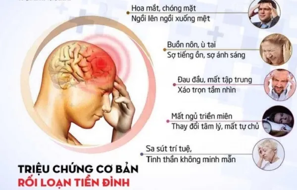 Hội chứng tiền đình nguy hiểm như thế nào? 1