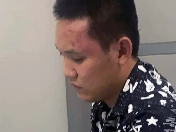 Tin nhanh chiều 6/10: Bé trai bị cha dùng xăng và rơm đốt ở Quảng Bình 4
