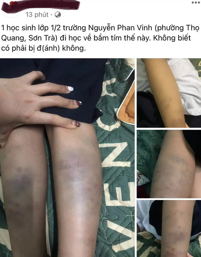 Tin nhanh chiều 6/10: Bé trai bị cha dùng xăng và rơm đốt ở Quảng Bình 5