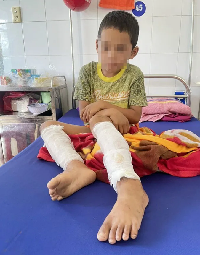 Tin nhanh chiều 6/10: Bé trai bị cha dùng xăng và rơm đốt ở Quảng Bình 1