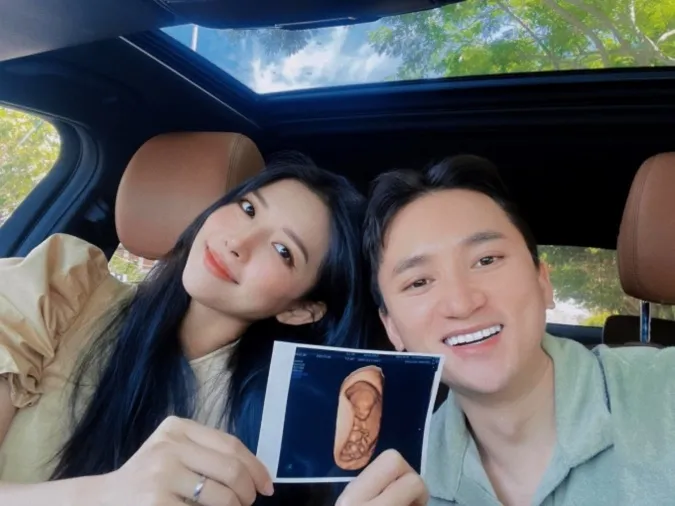 Vợ chồng Phan Mạnh Quỳnh khoe ảnh bầu bí tháng gần cuối thai kỳ 3
