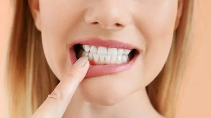Gần 50% dân số thế giới mắc bệnh răng miệng 1