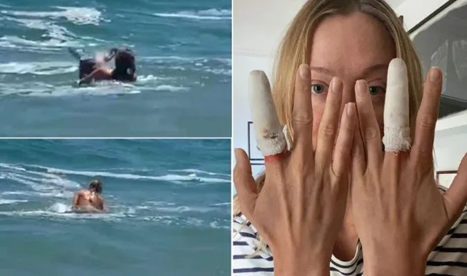 Một nữ diễn viên bị hải cẩu tấn công khi đang tắm biển 2