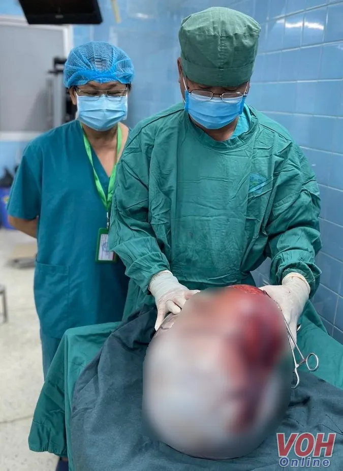 Nhiều trường hợp bướu to vài chục kg do ung thư phụ khoa phải nhập viện 2