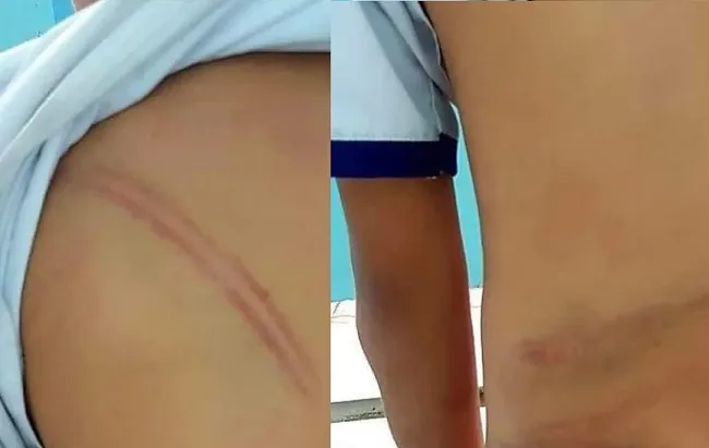 Khởi tố mẹ kế đánh con chồng thương tật 4% 1