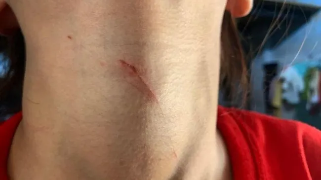 TPHCM: Thiếu nữ bị dí dao vào cổ, cướp bông tai giữa ban ngày 1