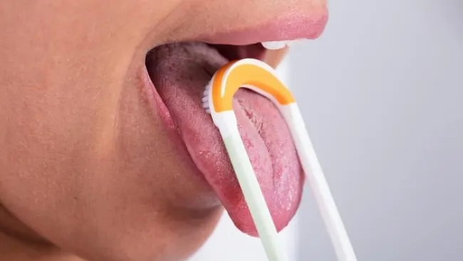 Bỏ qua việc làm sạch lưỡi trong khi đánh răng có thể không loại bỏ được mùi khó chịu trong miệng vì vi khuẩn có thể còm bám ở lưỡi gây hôi miệng - Ảnh: TVBS