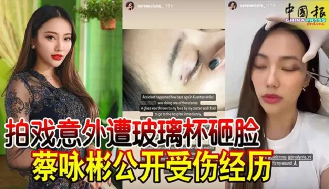 Thái Vịnh Bân bị diễn viên đối thủ ném ly thủy tinh vào mặt khi đang đóng phim 2