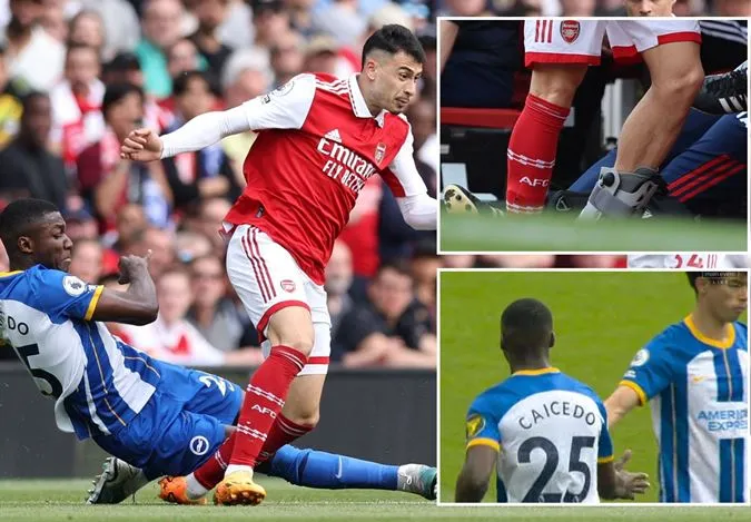 Tình huống triệt hạ của Caicedo với Martinelli - Ảnh: Internet