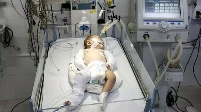 Vụ bạo hành bé gái 2 tháng tuổi: Cháu bé vẫn đang phải thở máy 1