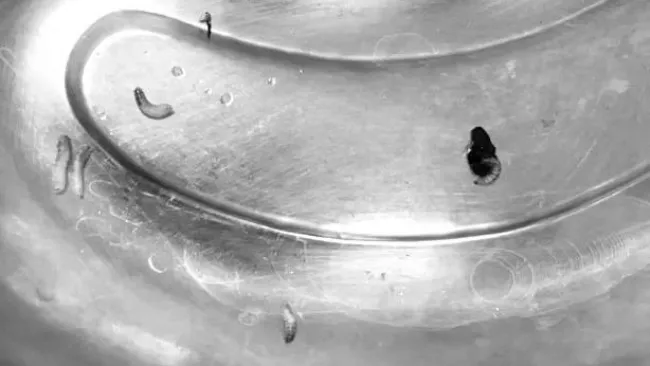 Phát hiện có hàng chục con giòi sống trong tai bệnh nhân 1