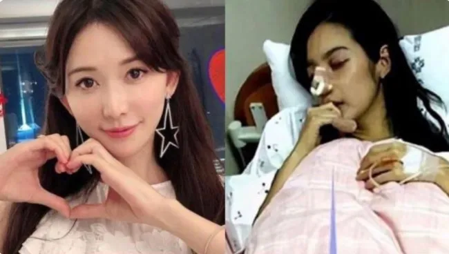 Lâm Chí Linh lần đầu phản ứng trước tin đồn bị chồng bạo hành đến gãy mũi 2