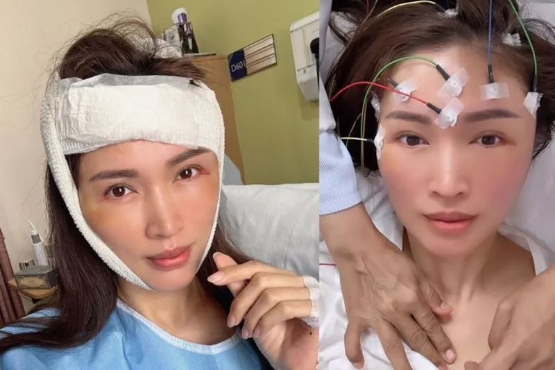 Siêu mẫu quốc tế bị ngã cầu thang đến mức phải phẫu thuật gấp trong đêm 2