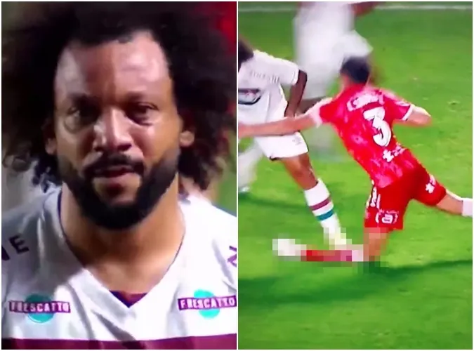 Kinh hoàng Marcelo đạp gãy chân đồng nghiệp, bật khóc ngay trên sân 1