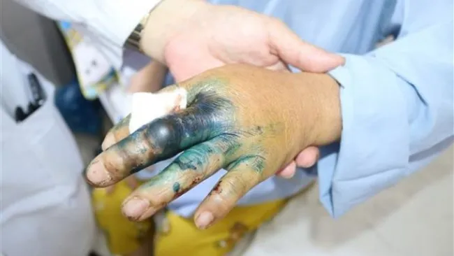 Điểm tin chiều 12/8: 8 trường hợp bị thu hồi cà vẹt xe | Nhiều trẻ bị rắn độc cắn 1