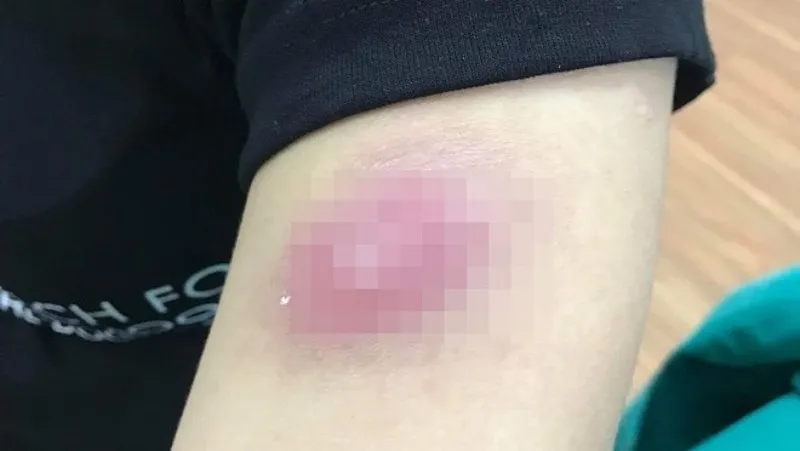 Điểm tin chiều 26/8: Phố núi Bảo Lộc ngập nặng | Tiêm tan mỡ nhận kết đắng 4