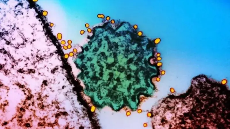 Những điều cần biết về virus Nipah, gây tử vong 40-75% 1