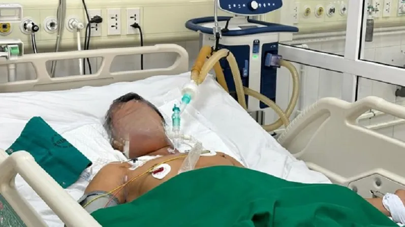 Bị uốn ván do cắt trĩ tại nhà 1