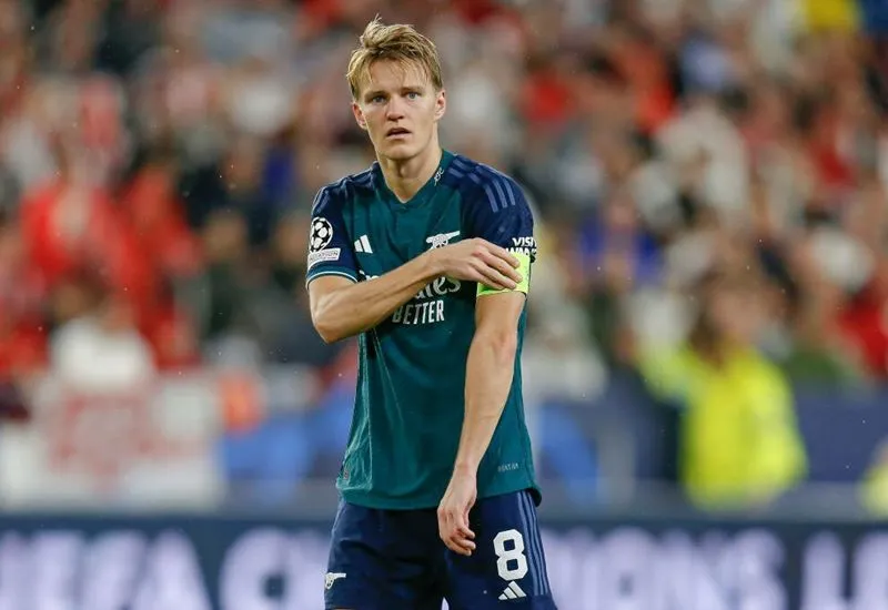 Mikel Arteta nói rõ lý do gạch tên Odegaard: Ai thể hiện không tốt đều có thể dự bị! 1