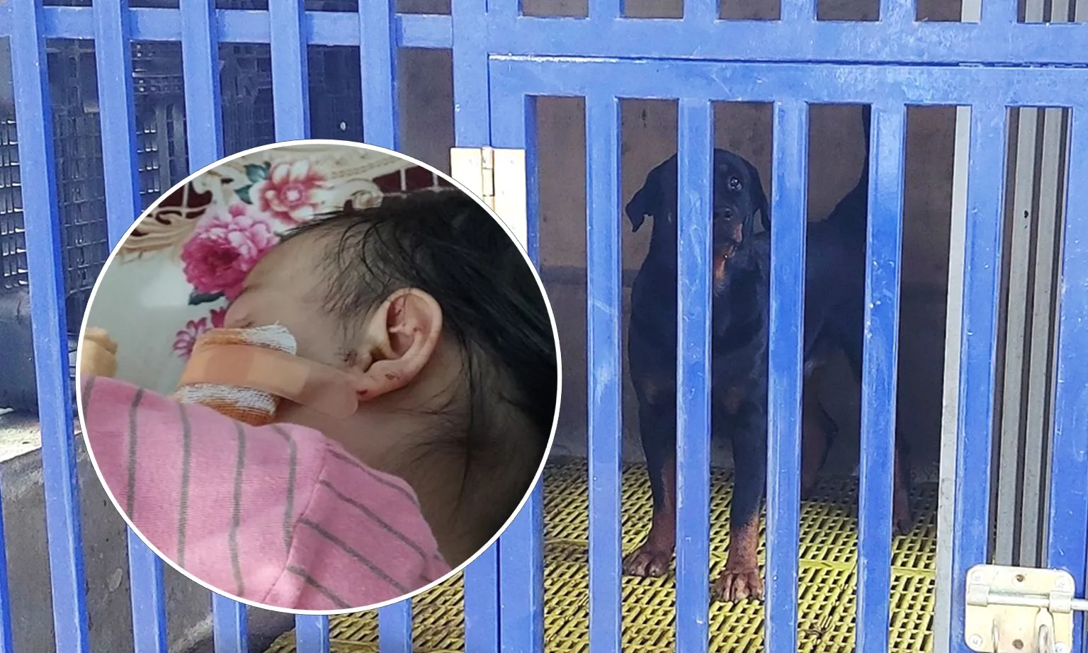 Bé gái phải khâu 16 mũi sau khi bị 2 con chó becgie  tấn công