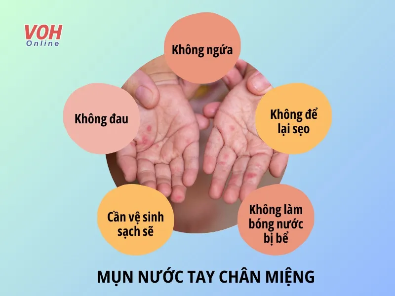 Trẻ mắc tay chân miệng nổi mụn nước nhiều có sao không? 1