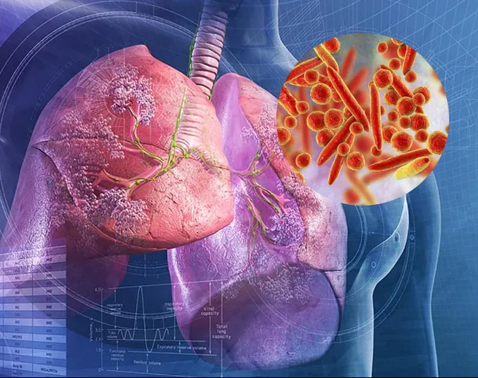 Mycoplasma - Nguyên nhân hàng đầu gây bệnh phổi trắng ở nhiều nơi 1