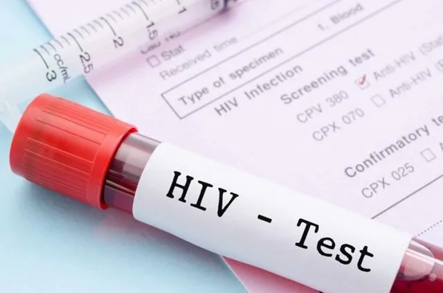 nhiễm HIV