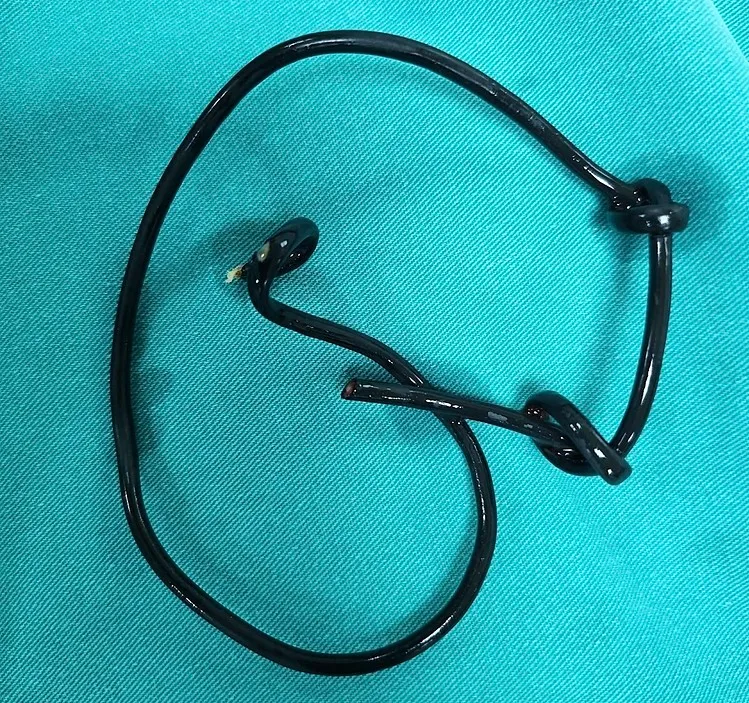 Nhịp Sống Khỏe 14/01: Nhập viện vì nhét dây điện vào đường tiểu | Mạo danh Sở Y tế TPHCM lợi dụng lòng tin người bệnh 1