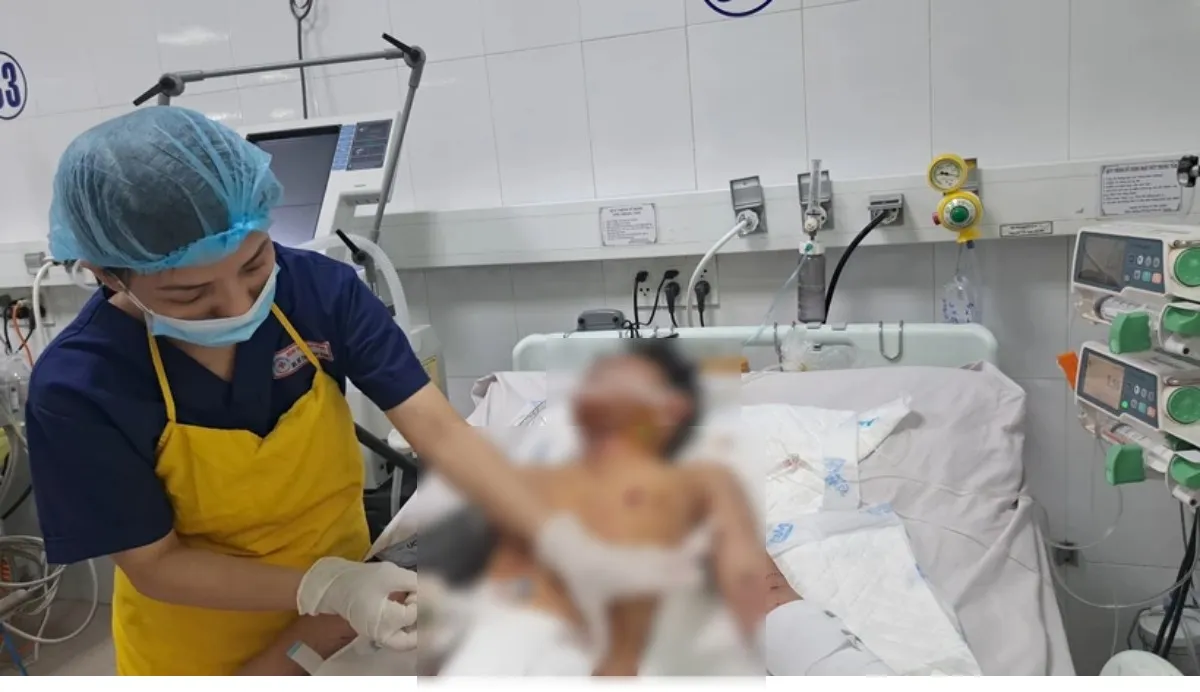 Thiếu niên bị chấn thương nặng do chơi pháo phát nổ