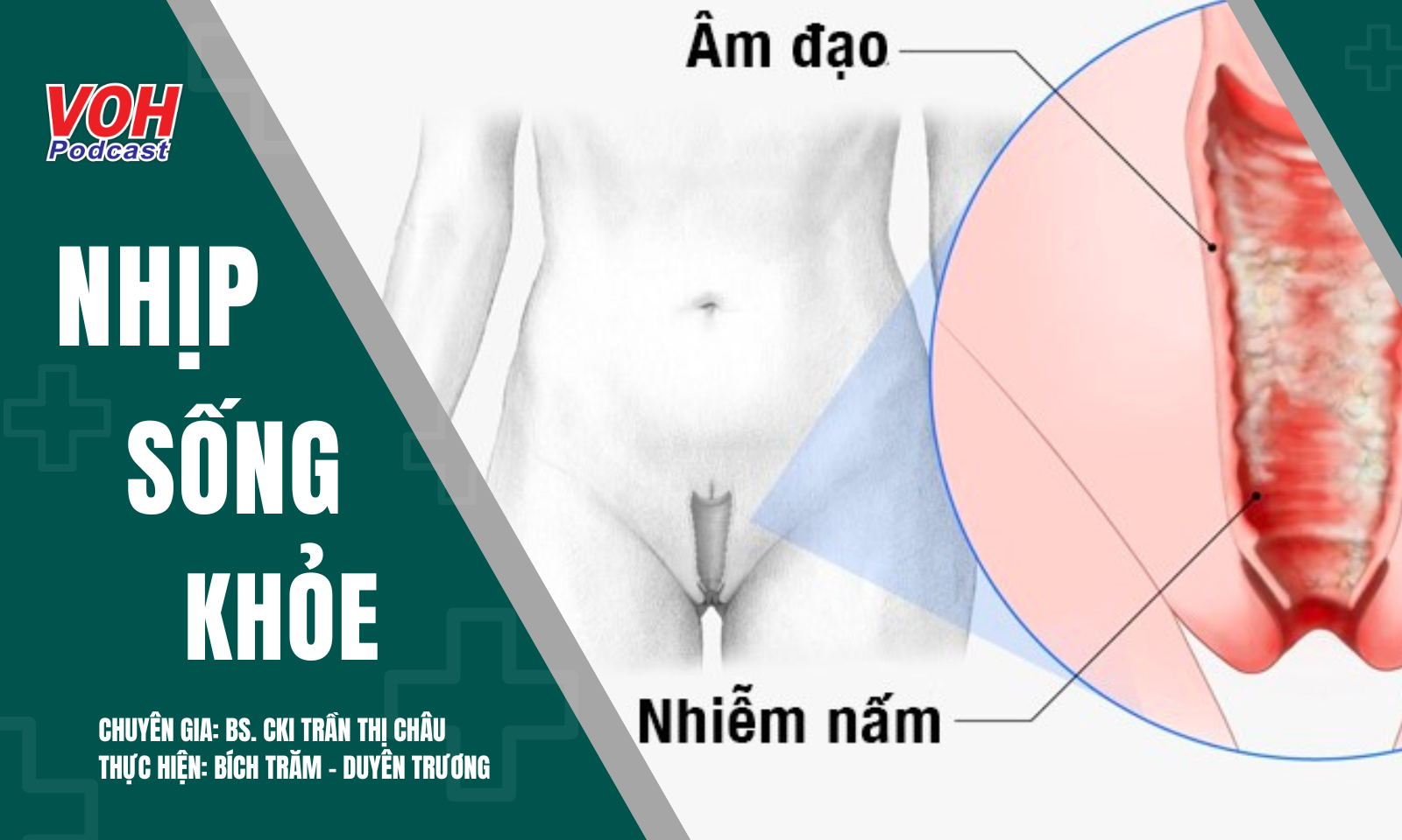 Viêm âm đạo do tạp khuẩn: Cách bảo vệ và phòng tránh