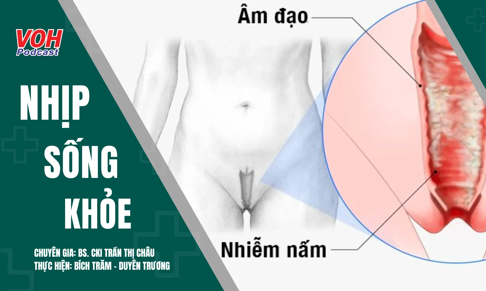 Viêm âm đạo do tạp khuẩn: Cách bảo vệ và phòng tránh