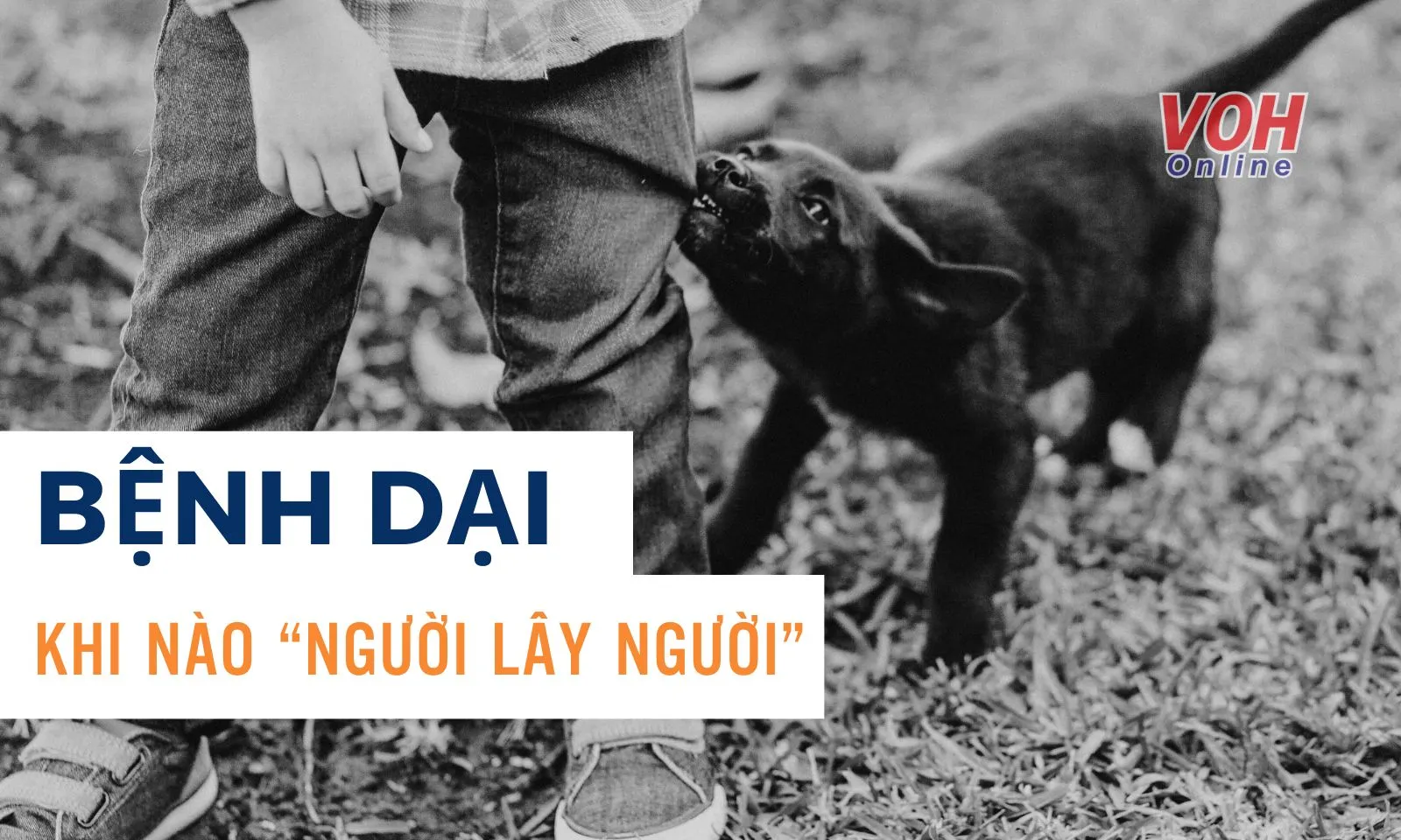 Bệnh dại có lây từ người sang người không?