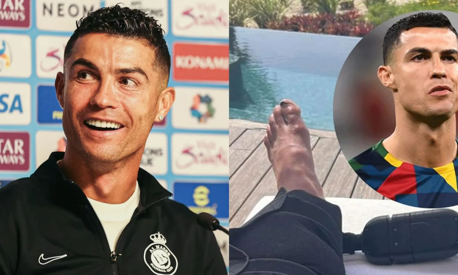 Khoe đôi chân biến dạng trên MXH, Ronaldo nhận phản ứng bất ngờ từ CĐV