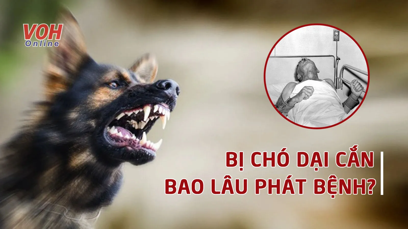 Thời gian ủ bệnh dại ở người là bao lâu?