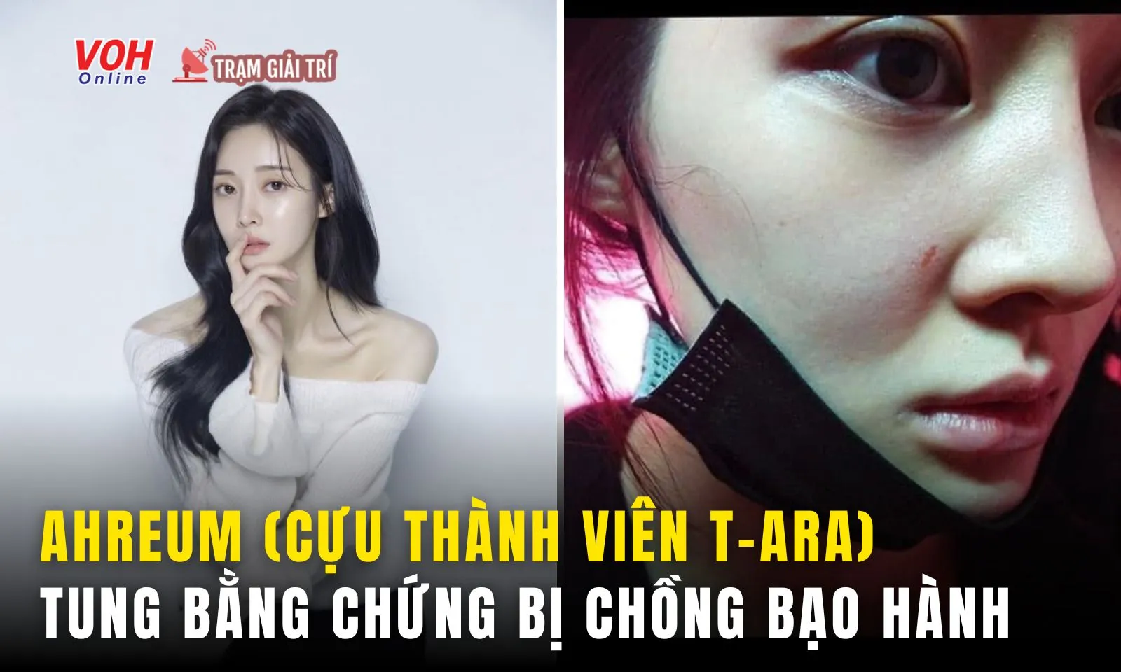 Ahreum (T-Ara) chịu bạo lực gia đình, để lộ dấu hiệu bất ổn