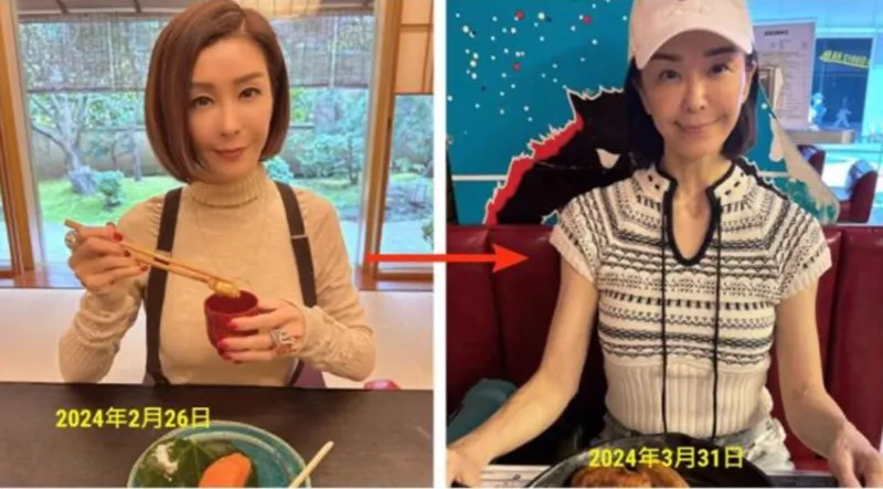 hình 2 - Ngũ Vịnh Vy trông rất gầy với hai tay chỉ còn da bọc xương và nổi đầy gân xanh