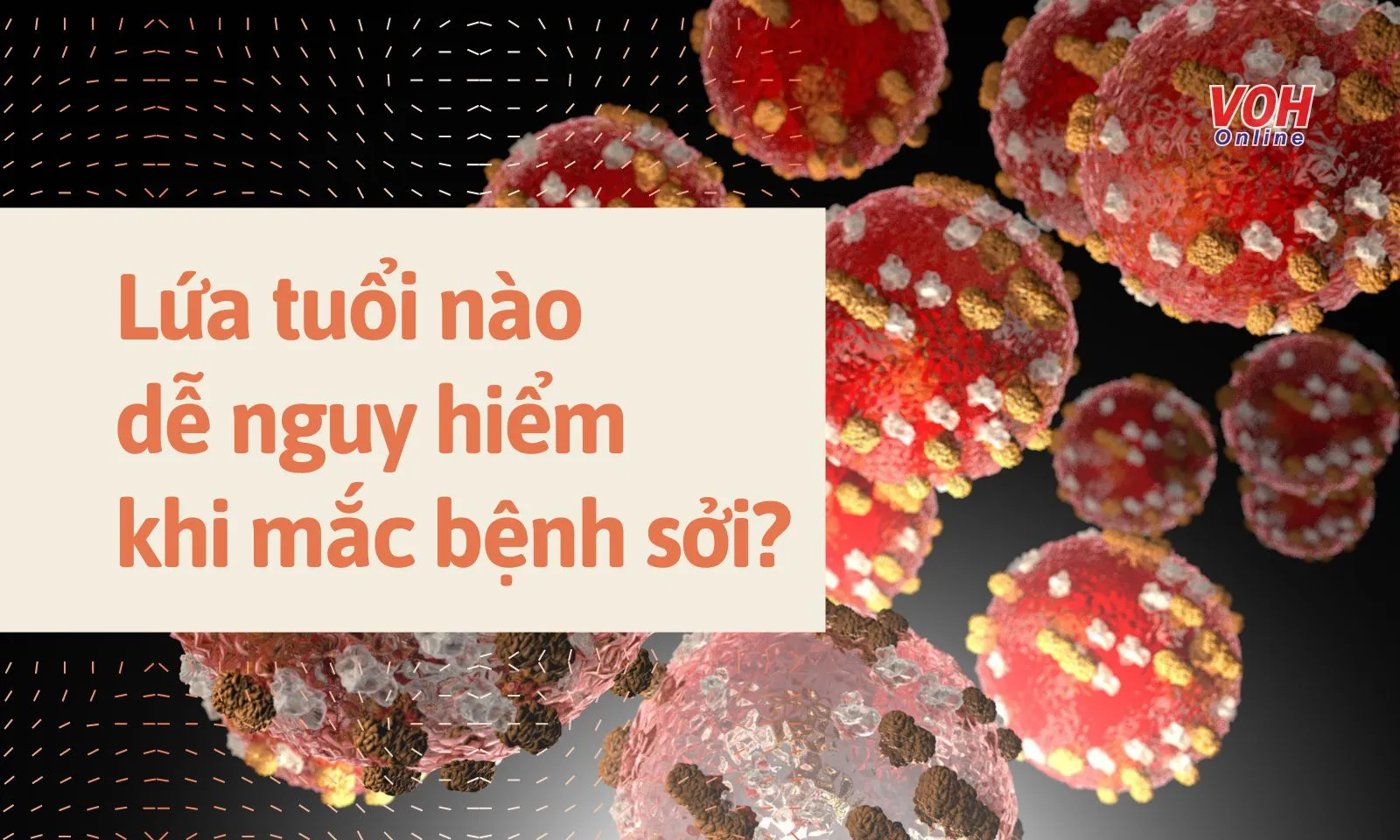 Tại sao bệnh sởi dễ bùng thành dịch? Lứa tuổi nào gặp nguy hiểm khi bị sởi?