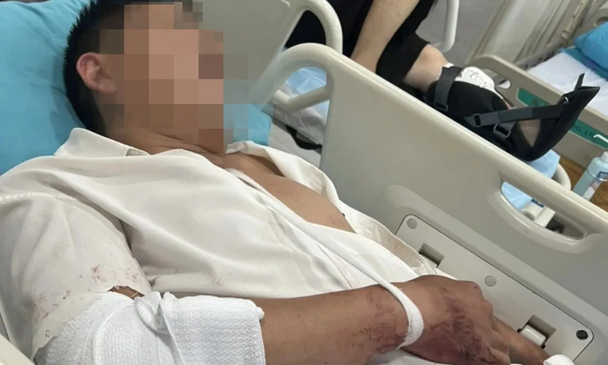 Lâm Đồng: Một thẩm phán bị chém trọng thương