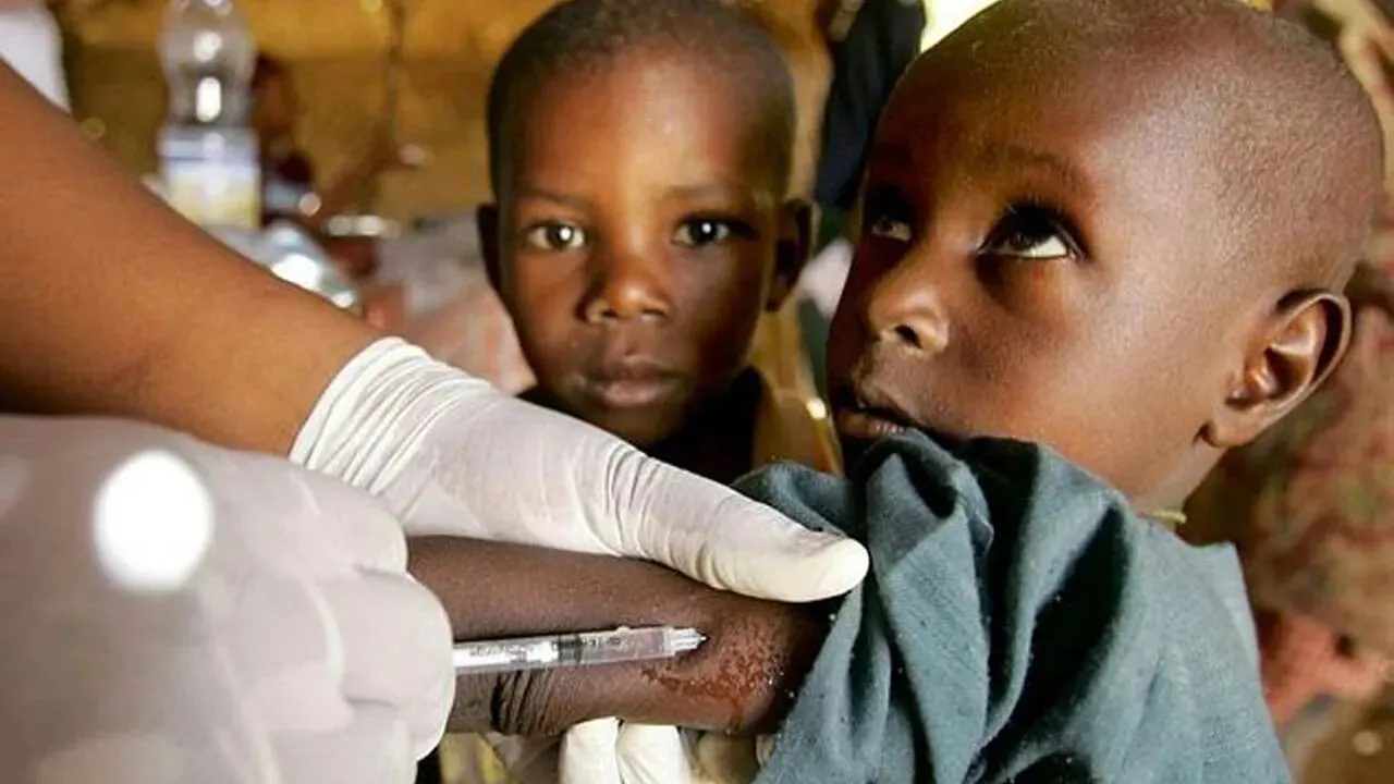Hàng chục trẻ em tử vong nghi do bệnh sởi bùng phát ở Nigeria
