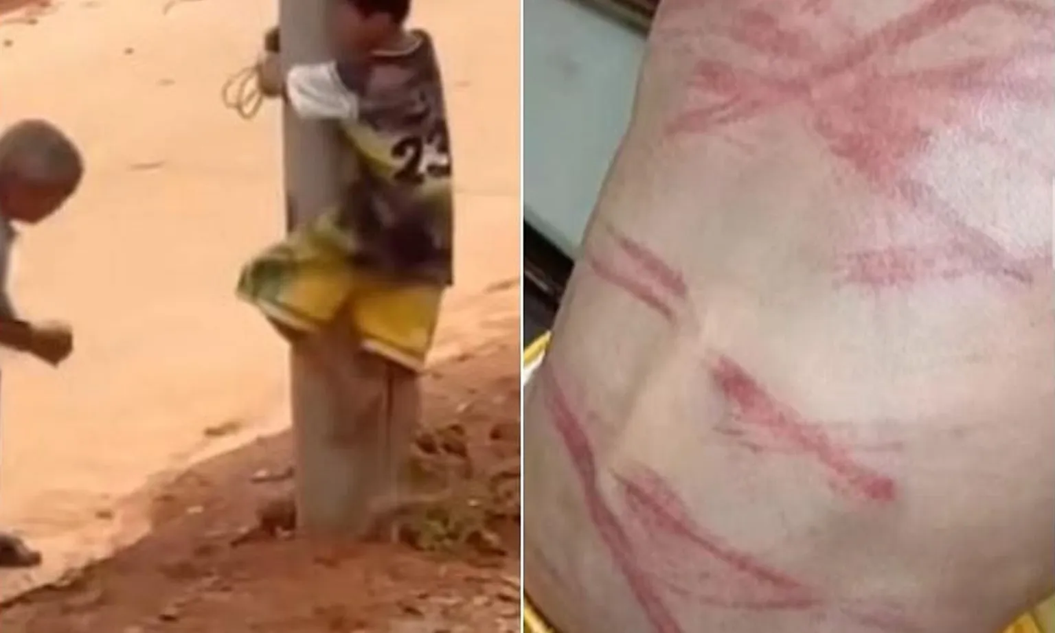 Trung Quốc: Cậu bé bị trói vào cột điện và quất tàn nhẫn bằng dây điện vì nghi trộm cắp